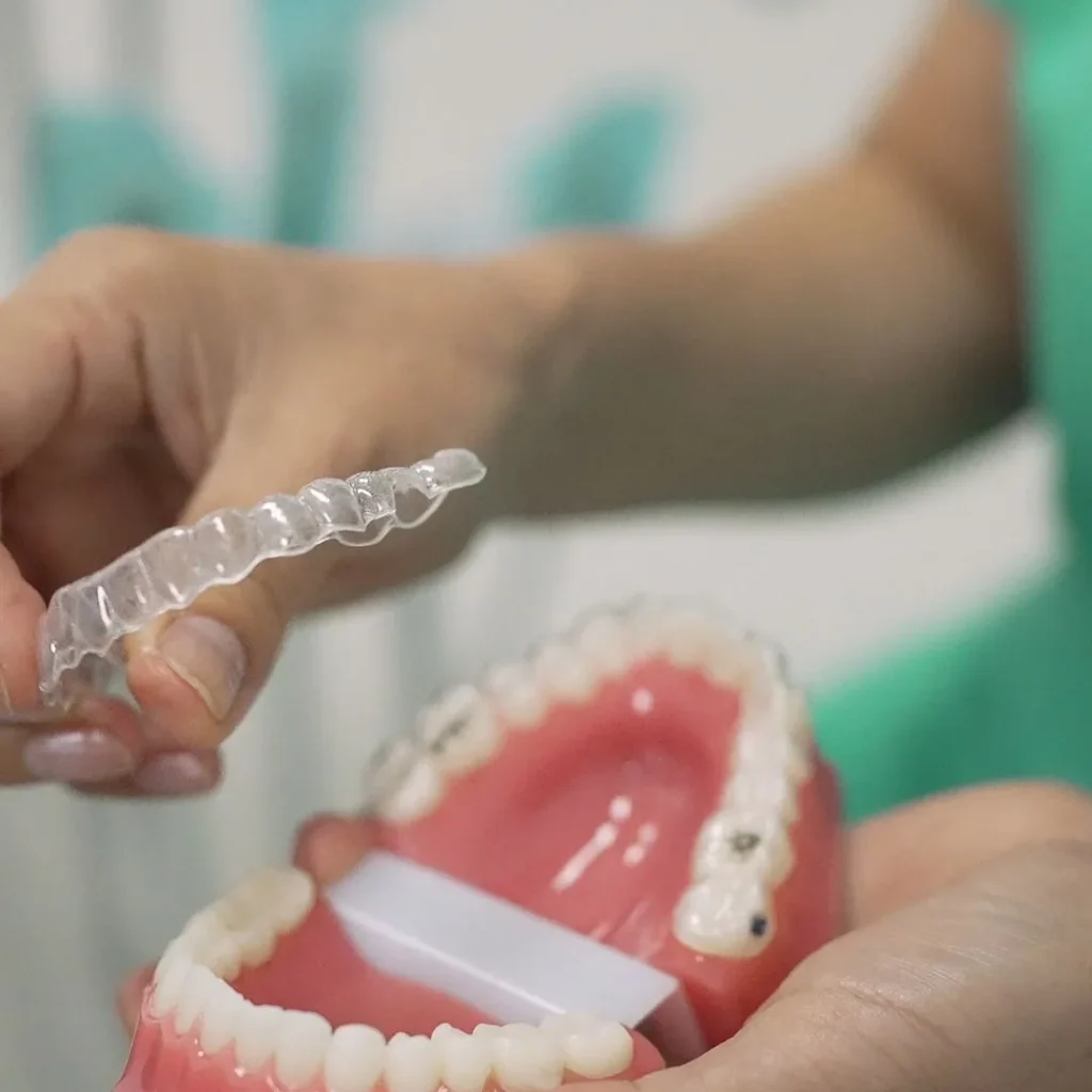 Clear braces in Vauxhall London