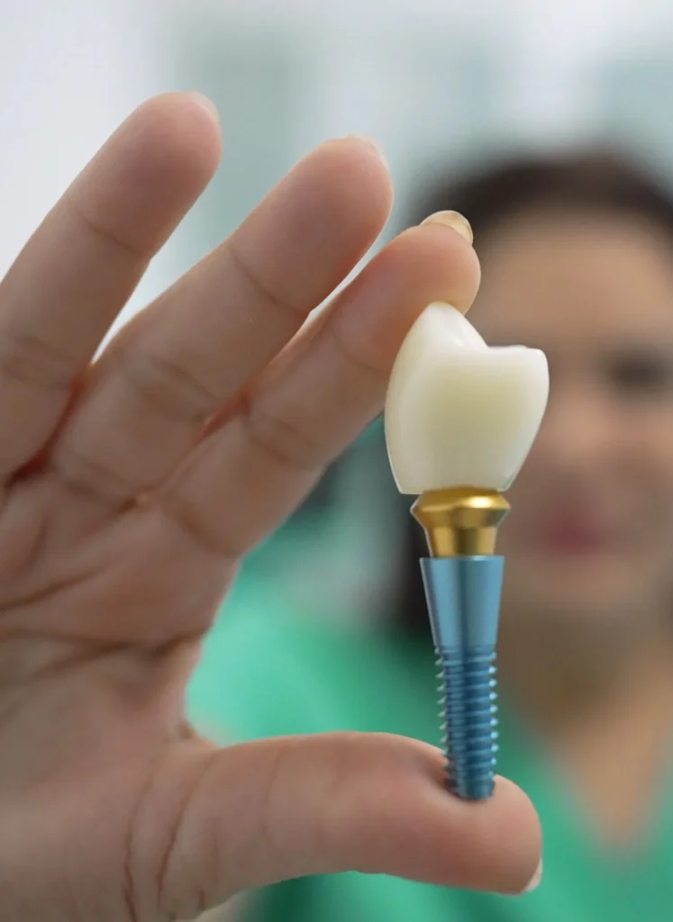 Dental Clinic in Vauxhall London