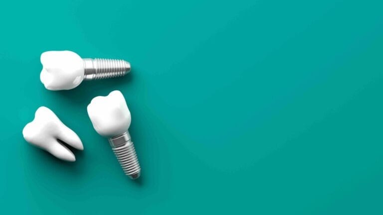 implantology glossary