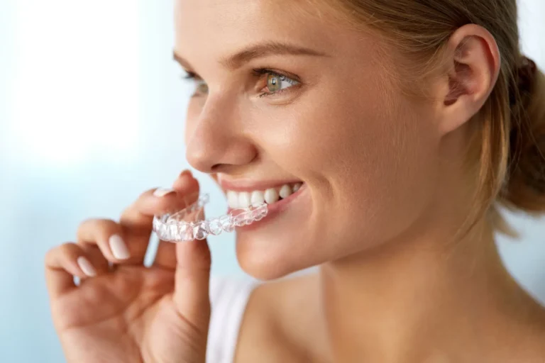 How many months does it take to straighten teeth with aligners