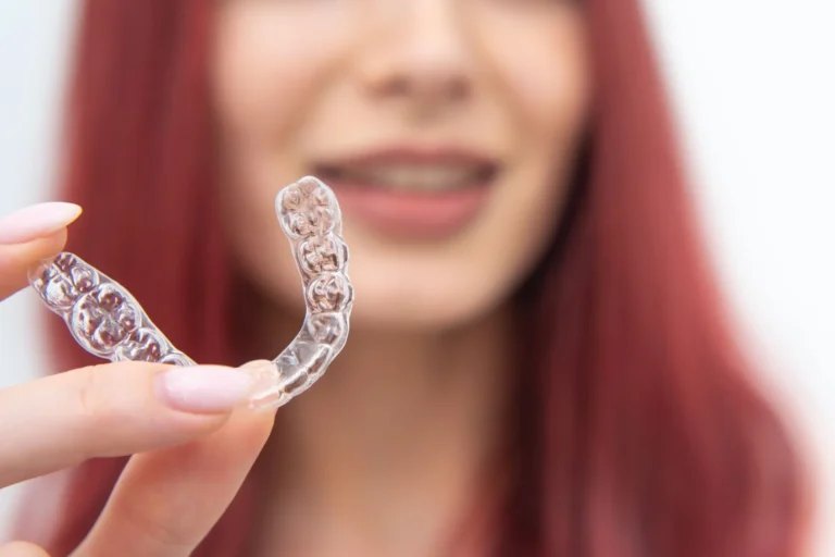 Blog 3 how long does clear braces take