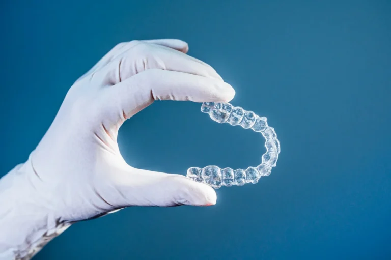 Blog 4 what are clear braces