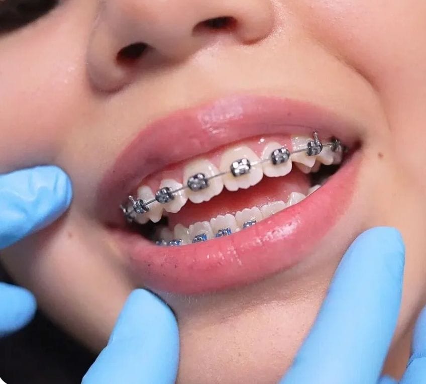Orthodontics 1 Screenshot 2025 09 15 alle 10.34.21