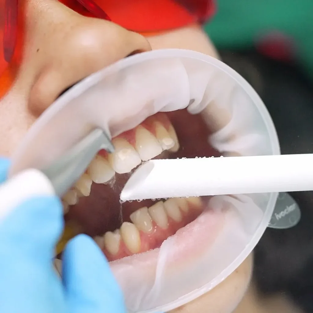 Super White Dental Clinic