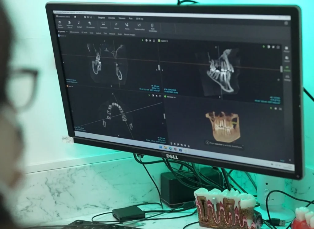How Much Are Dental Implants: A Complete Guide in Vauxhall London 1 How Much Are Dental Implants