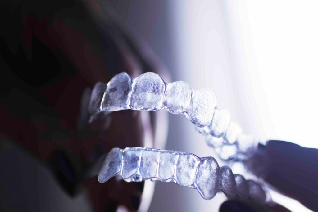 how clear aligners work