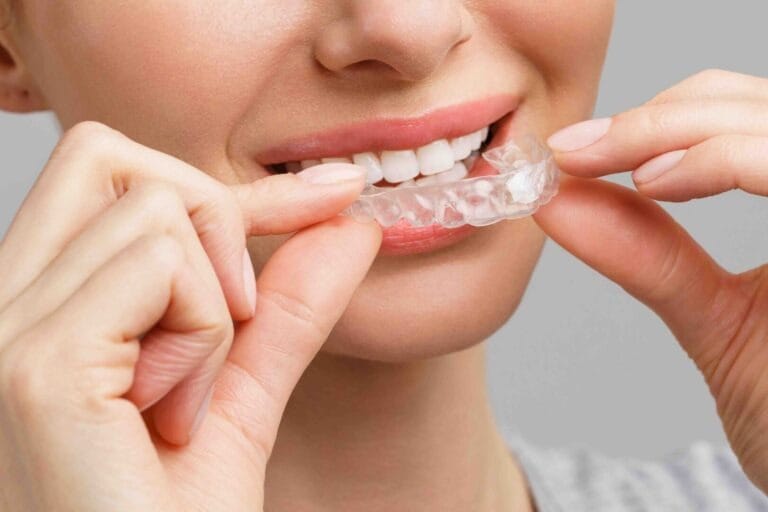 How long does an Invisalign treatment take on average