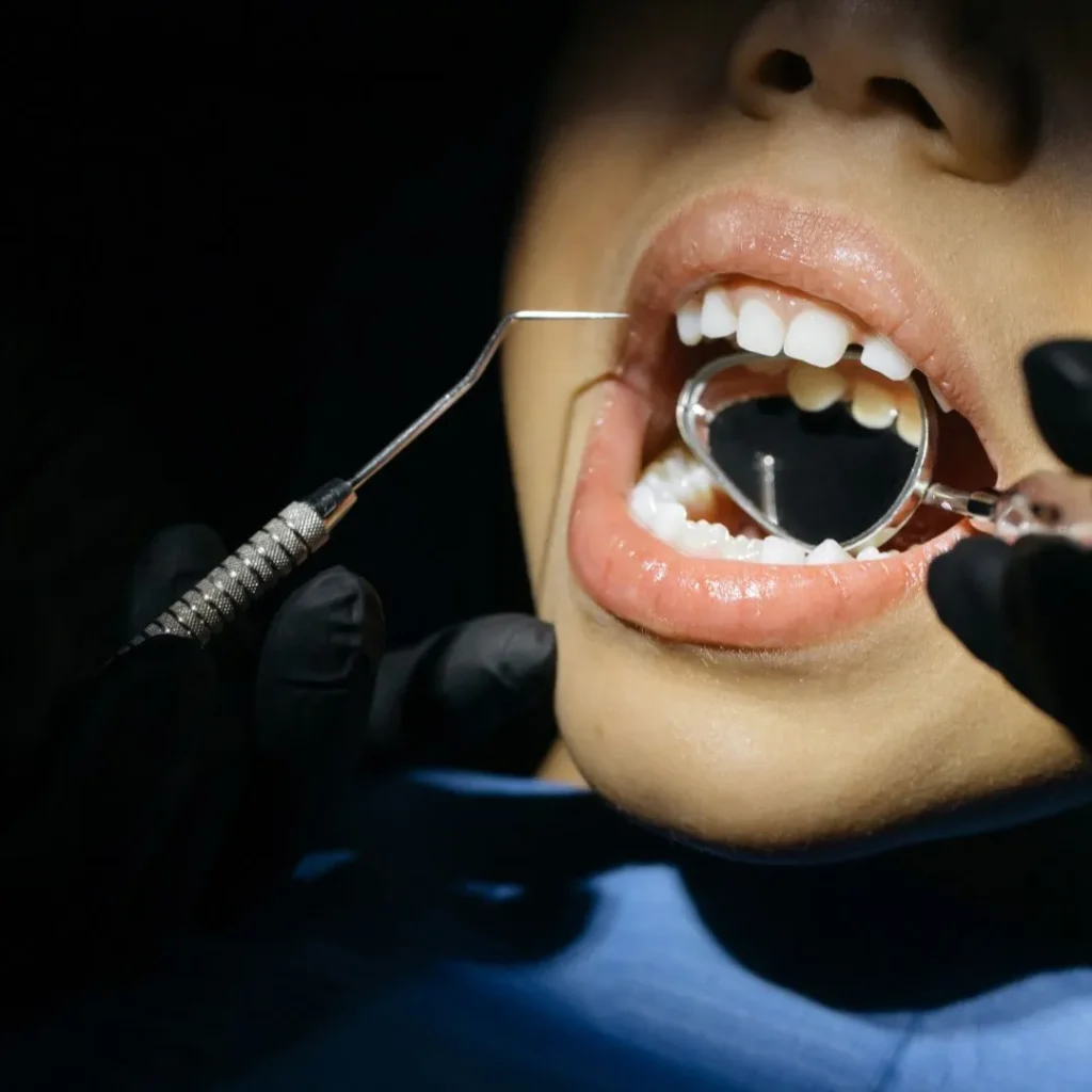 Pediatric Dentistry 1 Children’s dentist in Vauxhall London